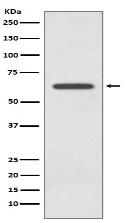 Glutaminase Antibody