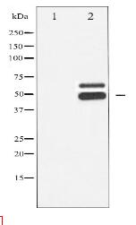 Phospho-CaMK2- beta/ gamma/ delta (Thr287) Antibody