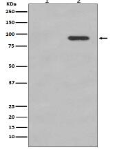 Phospho-beta Catenin (S33/S37) Antibody