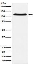 E1 Ubiquitin Activating Enzyme Antibody