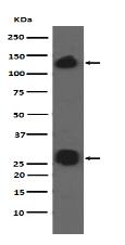 Integrin alpha V Antibody