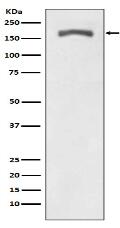 Phospho-PDGF Receptor beta (Y740) Antibody