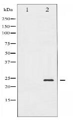 Phospho-BAD (Ser155) Antibody
