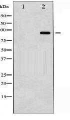 Phospho-Catenin- beta (Tyr489) Antibody