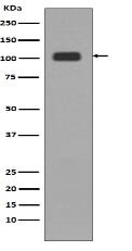 KDM1/LSD1 Antibody