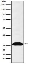 Human Kappa Chain Antibody