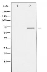 Phospho-Estrogen Receptor- alpha (Ser106) Antibody