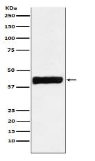 Creatine kinase B type Antibody