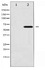 Phospho-Ezrin (Tyr146) Antibody