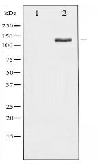 Phospho-FAK (Ser843) Antibody