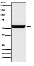 Monoamine Oxidase B Antibody