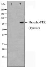Phospho-FER(Tyr402) Antibody