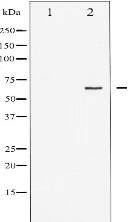 Phospho-Estrogen Receptor- alpha (Ser167) Antibody