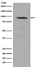 Phospho-Stat5 (Y694) Antibody