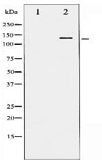 Phospho-FGFR1 (Tyr766) Antibody