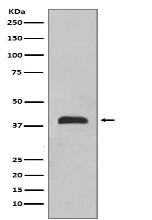 TTF1 Antibody