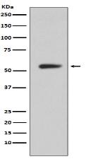 CA9 Antibody