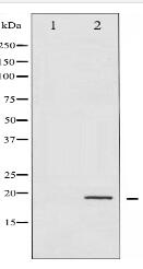 Phospho-4E-BP1 (Thr45) Antibody