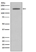 DAP Kinase 1 Antibody