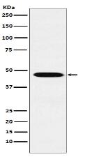 Wnt2b Antibody