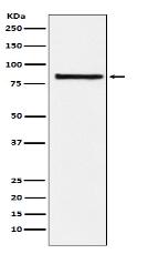 eIF2B epsilon Antibody