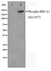 Phospho-BRCA1(Ser1457) Antibody