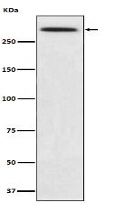 SPTA1 Antibody