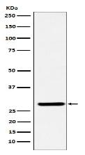 FHL2 Antibody