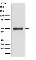 Cytokeratin 8 Antibody