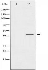 Phospho-CCR5 (Ser336) Antibody