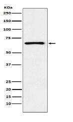 Parathyroid Hormone Receptor 1 Antibody