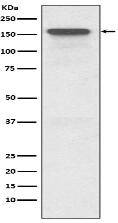 P Glycoprotein Antibody