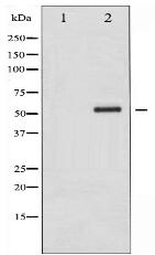 Phospho-Chk2 (Ser516) Antibody