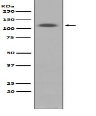 ABCG1 Antibody
