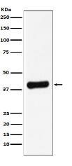 Galectin 8 Antibody