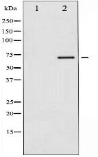 Phospho-Estrogen Receptor- alpha (Ser118) Antibody