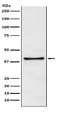 TRIB3 Antibody