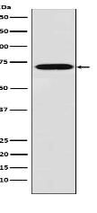Plastin L Antibody