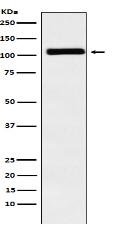 MIB1 / DIP1 Antibody