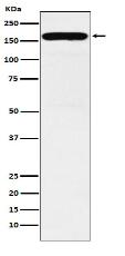 DIAPH1 Antibody