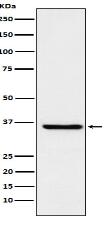 GSTO1 Antibody