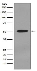 Cytokeratin 7 Antibody