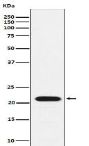 CBFb Antibody
