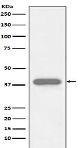 Troponin T Antibody