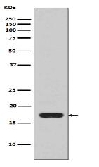 IL1 beta Antibody