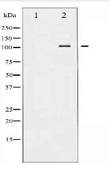 PKD1/PKC μ Antibody