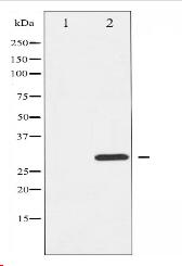 Phospho-BIK (Thr33) Antibody