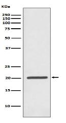 Ferritin Antibody