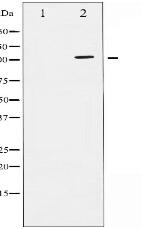 Phospho-ATPase (Ser16) Antibody