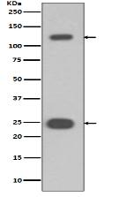 PARP Antibody